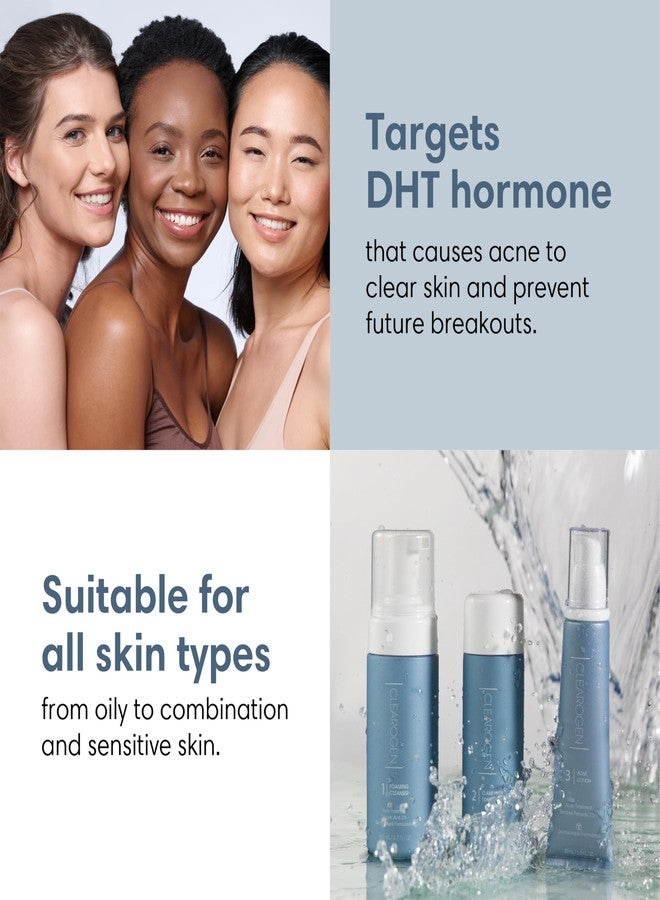 كليروجين مجموعة علاج حب الشباب، مجموعة علاج حب الشباب، العناية بالبشرة لعلاج حب الشباب، مجموعة العناية بالبشرة المعرضة لحب الشباب، مجموعة فاخرة طبيعية مضادة لهرمون ديهدروتستوستيرون، تركيبة أصلية، مجموعة بنزويل بيروكسيد من 3 قطع، تكفي لمدة شهر واحد - Image 5